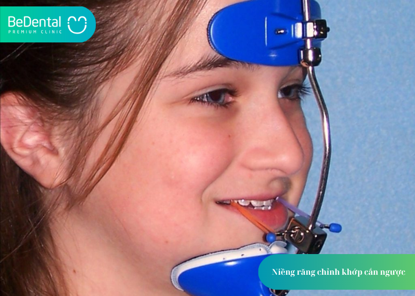 How much does teeth whitening cost 16 1