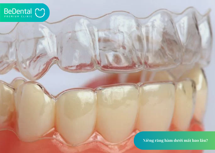 How much does teeth whitening cost 2 2