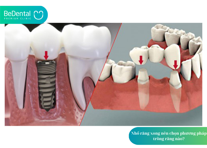 How much does teeth whitening cost 2 4