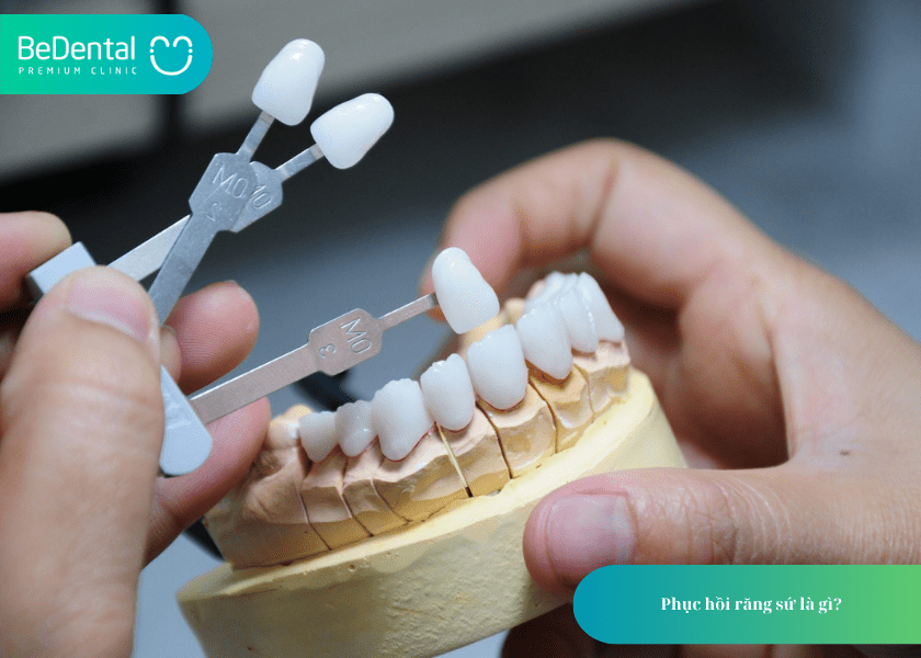 Phục hồi răng sứ là gì?