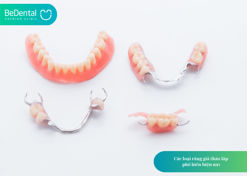 Bộ răng giả: Giải pháp phục hình linh hoạt và tiết kiệm cho người mất răng 3 How much does teeth whitening cost 2 min 14