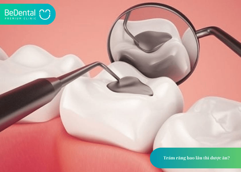How much does teeth whitening cost 2 min 18