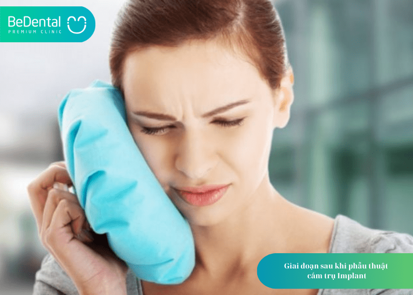 5 lưu ý sau khi cấy ghép implant để phục hồi nhanh và bền vững 2 Lưu ý sau khi cấy ghép implant