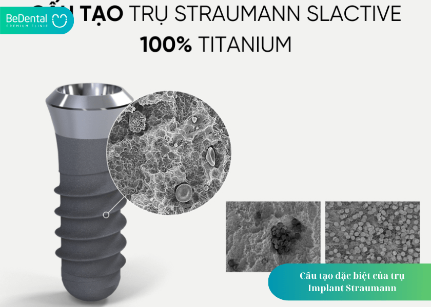 Trụ Implant Straumann: Giải pháp trồng răng chất lượng hàng đầu đến từ Thụy Sĩ 2 Cấu tạo đặc biệt của trụ Implant Straumann