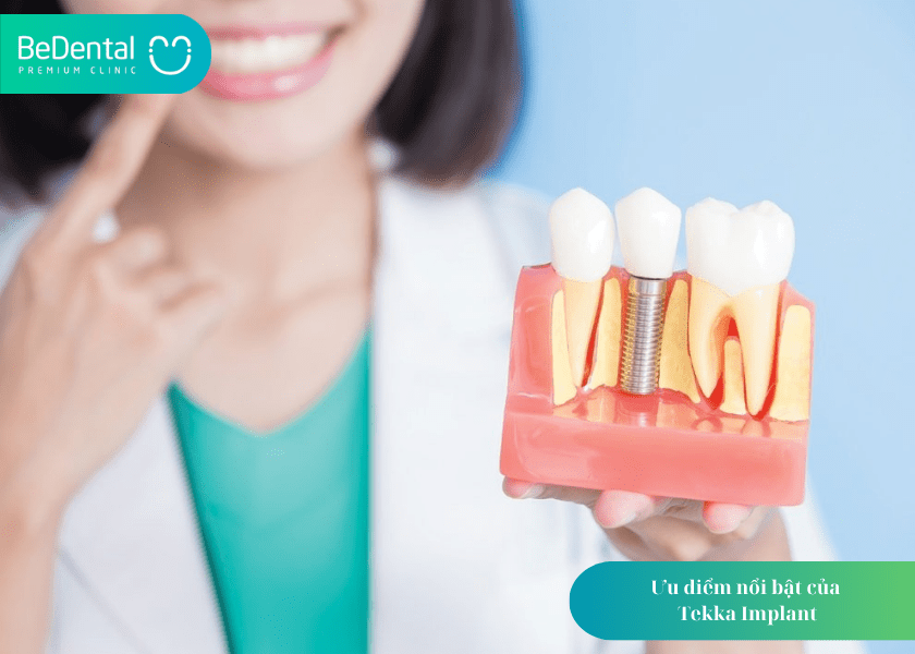 Tekka Implant – Giải pháp cấy ghép Implant tiên tiến đến từ Pháp 4 How much does teeth whitening cost 2 min 5