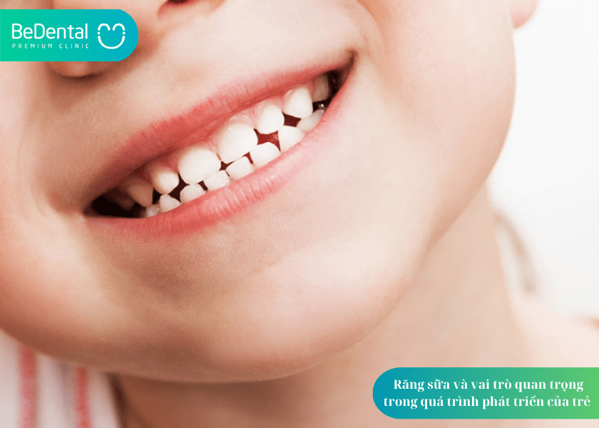 Chữa tủy răng sữa: Vì sao cần thiết và nên thực hiện thế nào để đảm bảo sức khỏe răng miệng lâu dài cho trẻ? 2 How much does teeth whitening cost 2 min 7