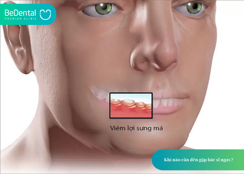 Lấy Tủy Răng Xong Có Đau Không? Chuyên Gia Giải Đáp Từ A–Z 6 How much does teeth whitening cost 2 min 9