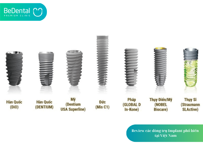Review trồng răng Implant tại Việt Nam 3 How much does teeth whitening cost 3 min 14