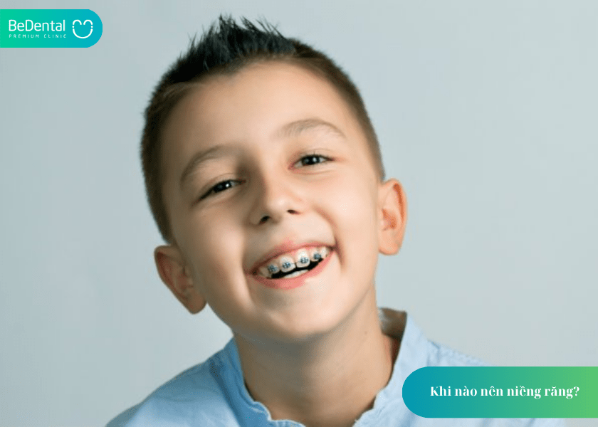 Khi nào nên niềng răng? 4 dấu hiệu cần biết để không bỏ lỡ thời điểm vàng 3 How much does teeth whitening cost 3 min 2