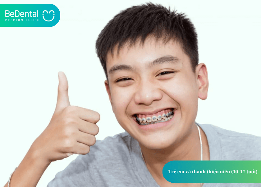 How much does teeth whitening cost 3 min 20