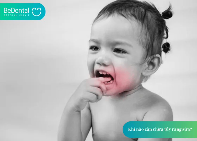 Chữa tủy răng sữa: Vì sao cần thiết và nên thực hiện thế nào để đảm bảo sức khỏe răng miệng lâu dài cho trẻ? 3 How much does teeth whitening cost 3 min 8