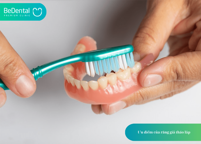 Bộ răng giả: Giải pháp phục hình linh hoạt và tiết kiệm cho người mất răng 5 How much does teeth whitening cost 4 min 13
