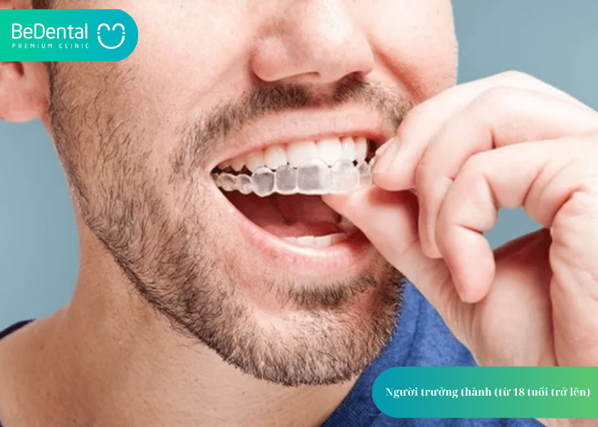 How much does teeth whitening cost 4 min 17