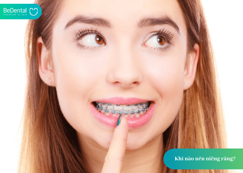 Khi nào nên niềng răng? 4 dấu hiệu cần biết để không bỏ lỡ thời điểm vàng 4 How much does teeth whitening cost 4 min 2