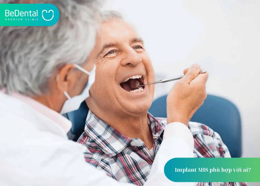 Implant MIS là gì? 5 điều quan trọng bạn cần biết trước khi lựa chọn 4 How much does teeth whitening cost 4 min