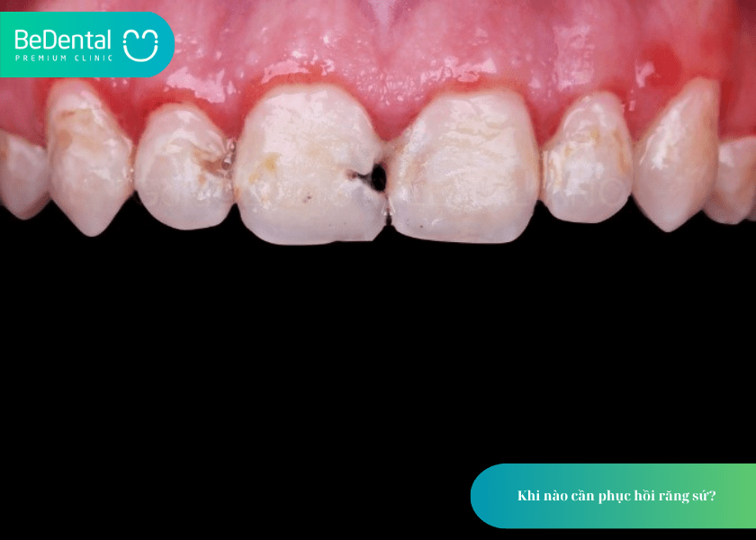 How much does teeth whitening cost 5 min 10