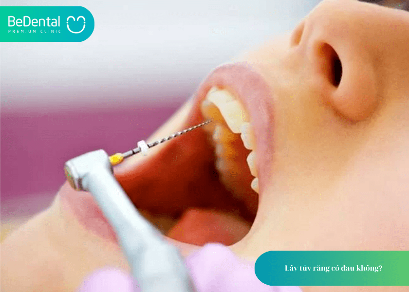 How much does teeth whitening cost 6 min 11