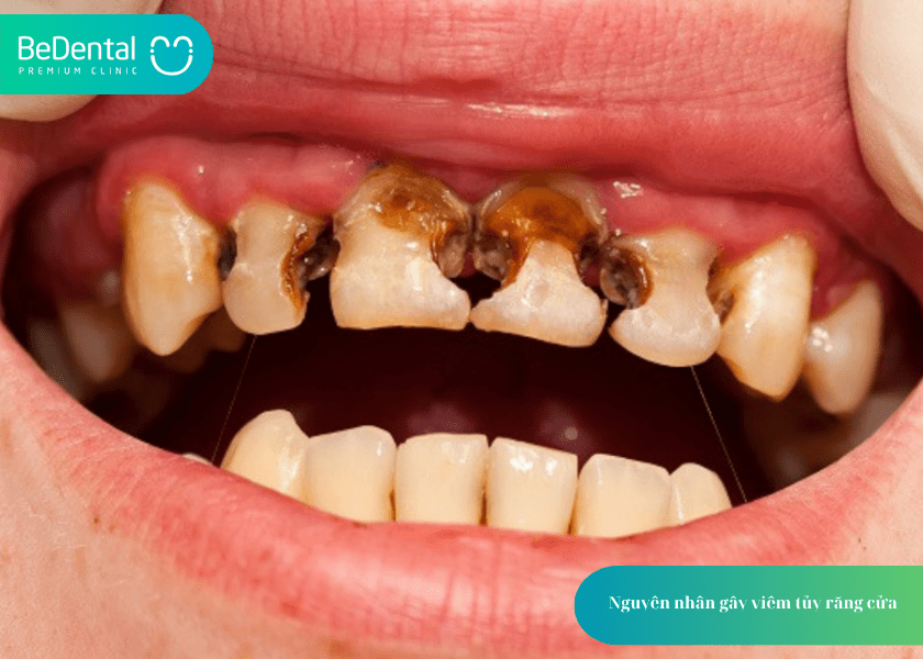 How much does teeth whitening cost 7 min 10