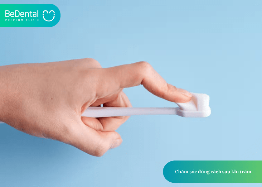 Có nên trám răng không? 4 lợi ích của trám răng bạn cần biết 6 Có nên trám răng không?