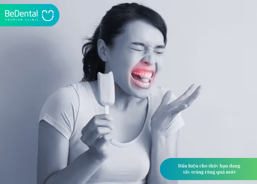Có nên tẩy trắng răng nhiều lần? Hiểu đúng để bảo vệ nụ cười khỏe đẹp 7 How much does teeth whitening cost 7 min 6