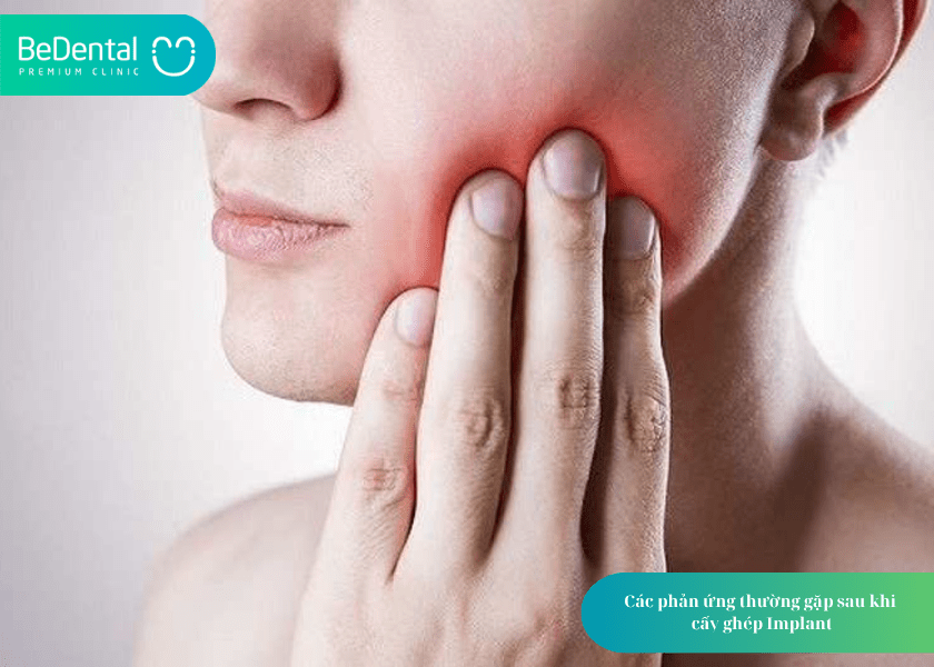 5 lưu ý sau khi cấy ghép implant để phục hồi nhanh và bền vững 7 How much does teeth whitening cost 8 min 10