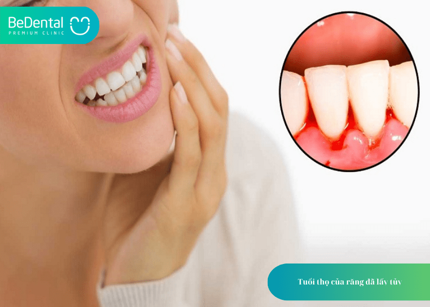 How much does teeth whitening cost 8 min 8