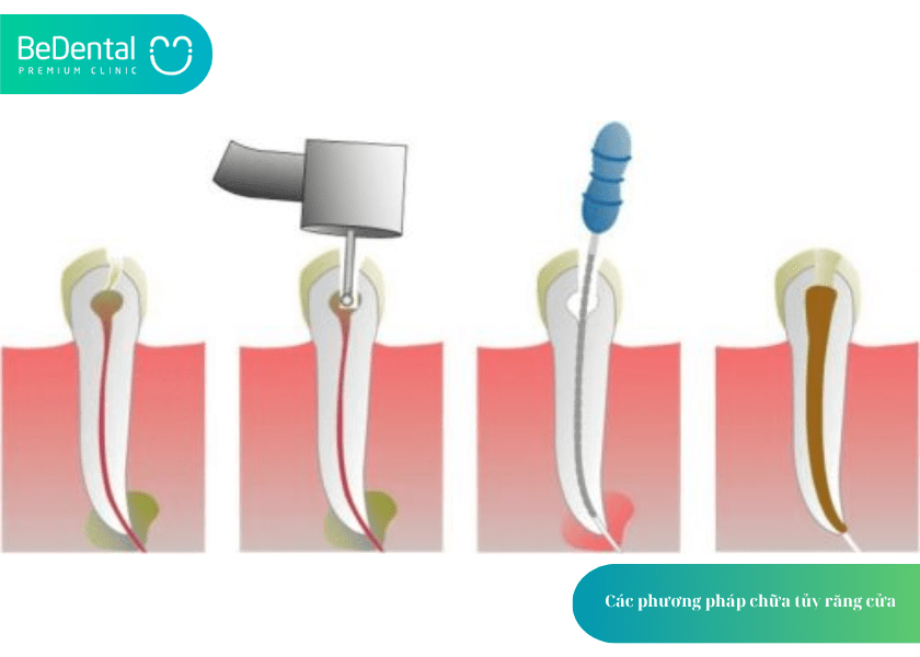 How much does teeth whitening cost 9 min 6