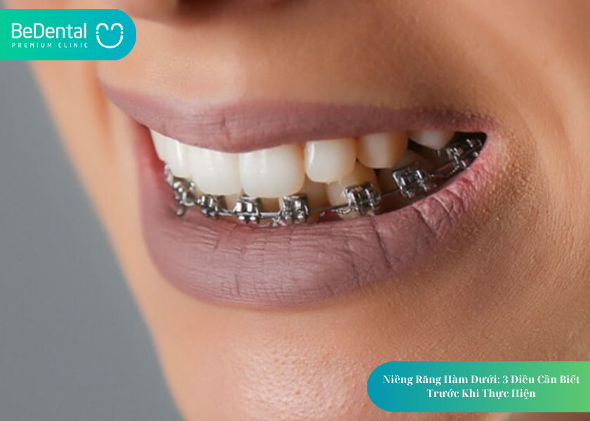 How much does teeth whitening cost 9