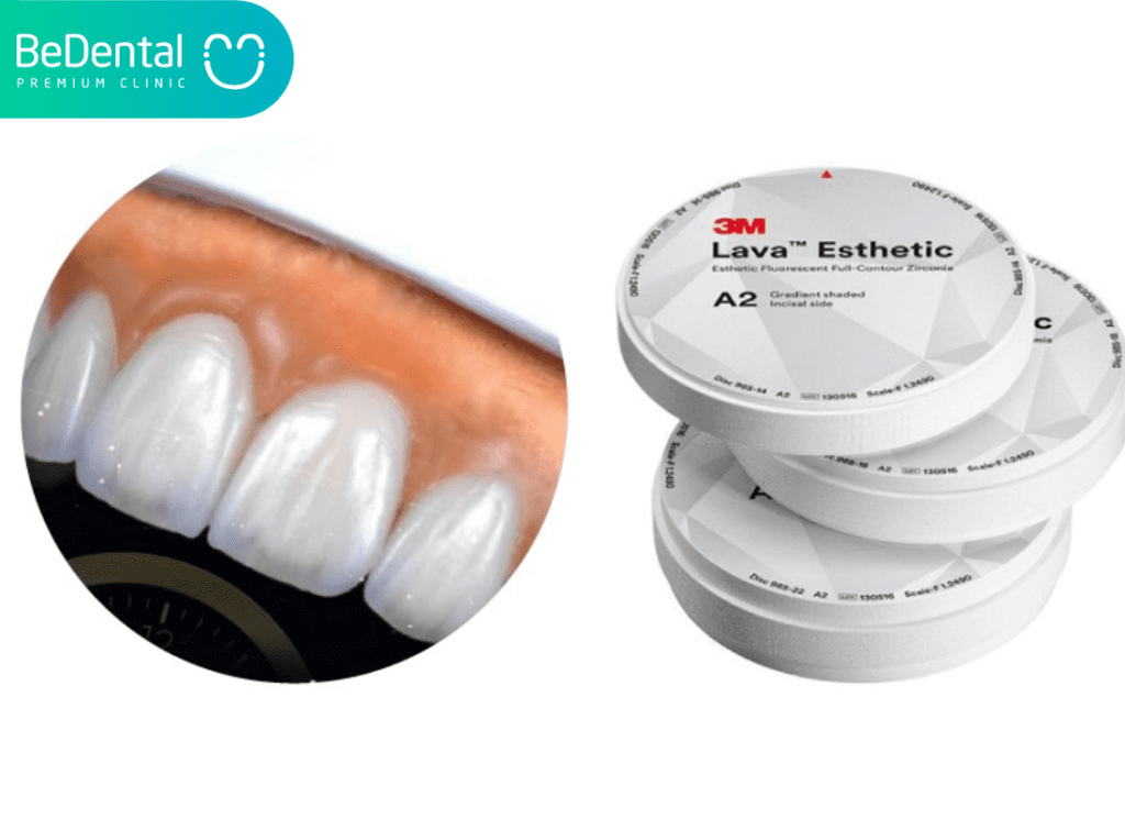 Lava esthetic gia bao nhieu