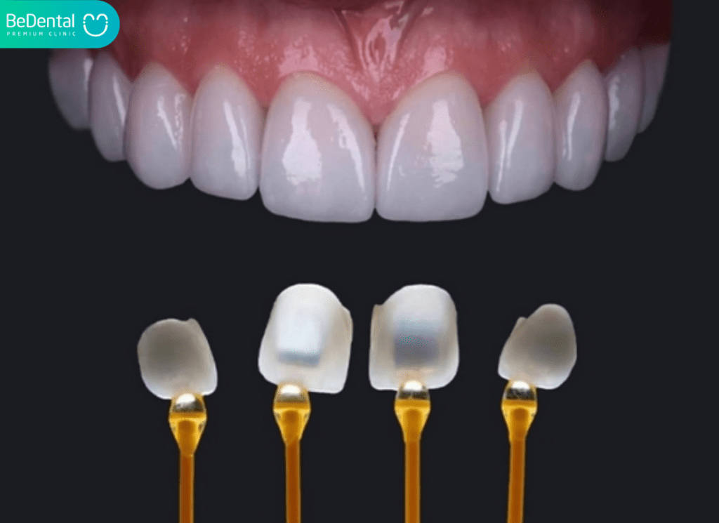 Mat dan su Veneer