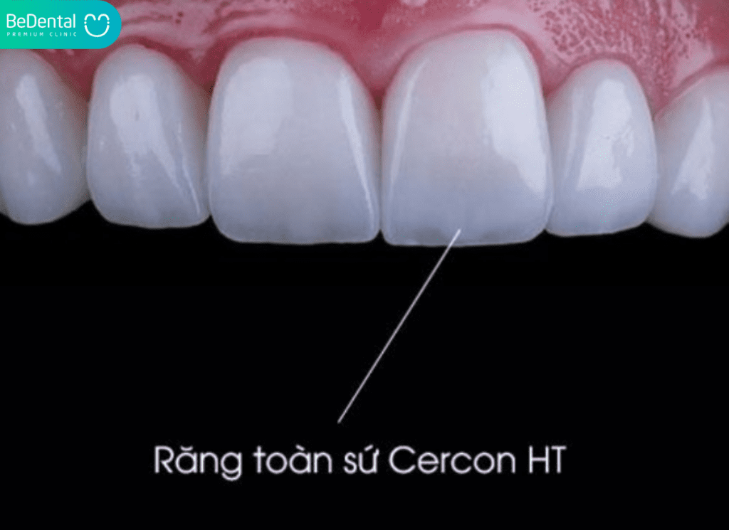 Cercon HT