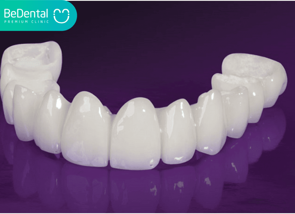 Răng toàn sứ lava plus