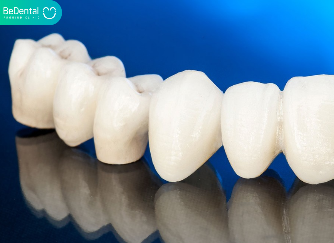 Rang toan su zirconia