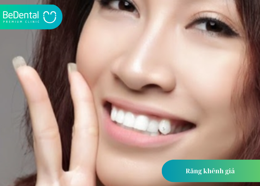 Răng khênh giả