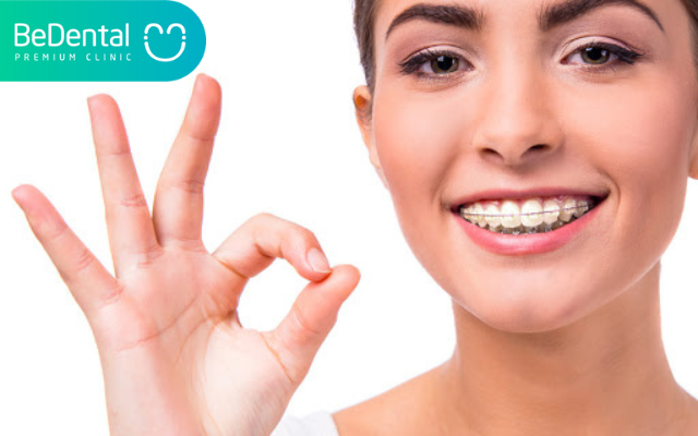 Tại sao niềng răng hóp má?