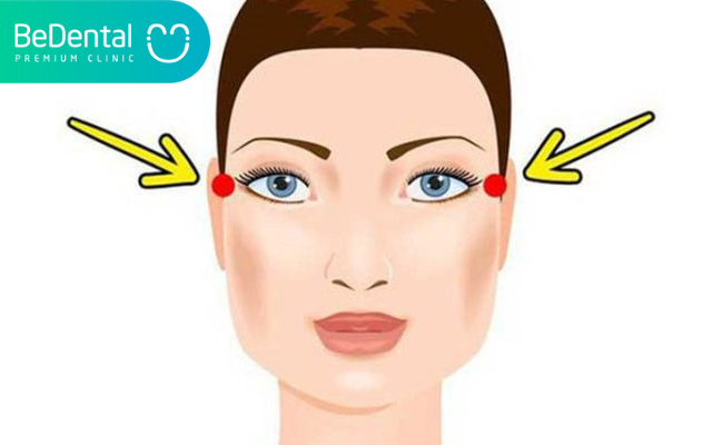 Tại sao niềng răng hóp má?