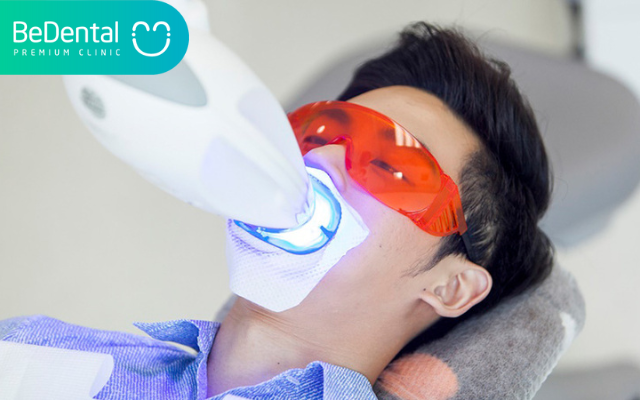 Tẩy trắng răng bằng đèn plasma 2 Tẩy trắng răng bằng đèn Plasma