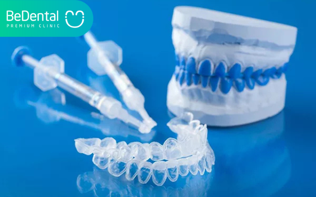 Tẩy trắng răng xong bị vàng lại