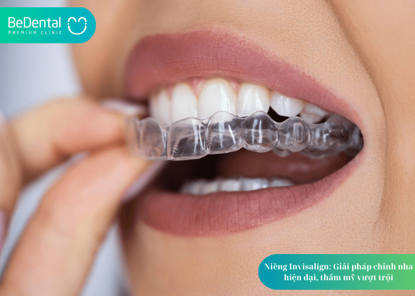 How much does teeth whitening cost 1 min 13