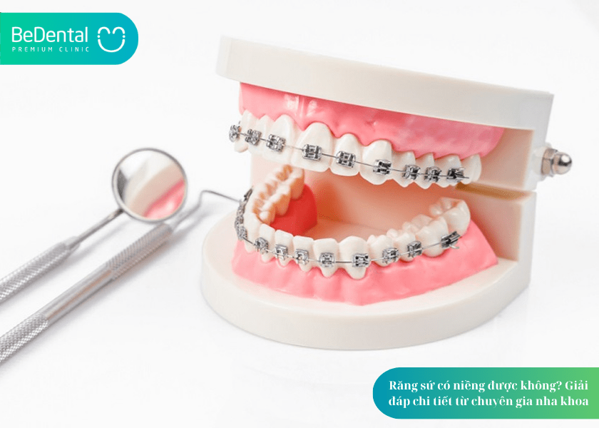How much does teeth whitening cost 1 min 8