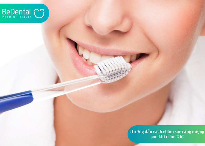 GIC là gì? 1 trong 3 vật liệu trám răng phổ biến trong nha khoa 5 How much does teeth whitening cost 10 3