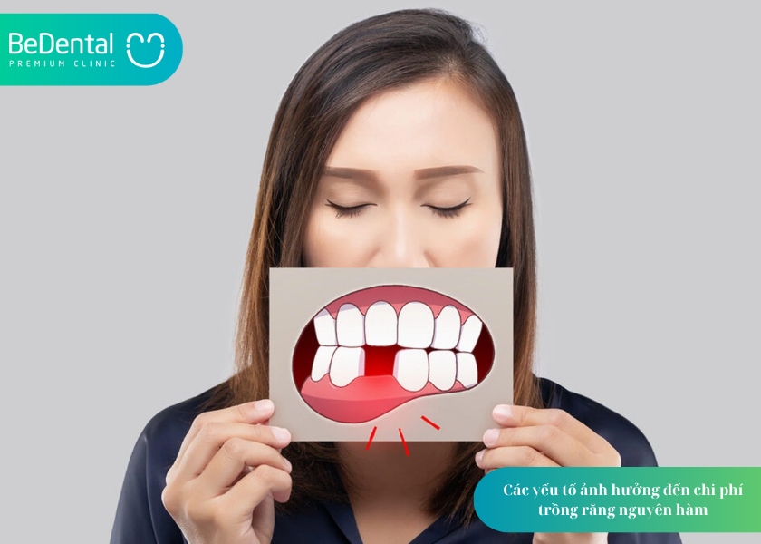 GIÁ LÀM RĂNG GIẢ NGUYÊN HÀM: 3 THÔNG TIN CHI TIẾT CHO NGƯỜI MẤT RĂNG TOÀN HÀM 4 How much does teeth whitening cost 10 6