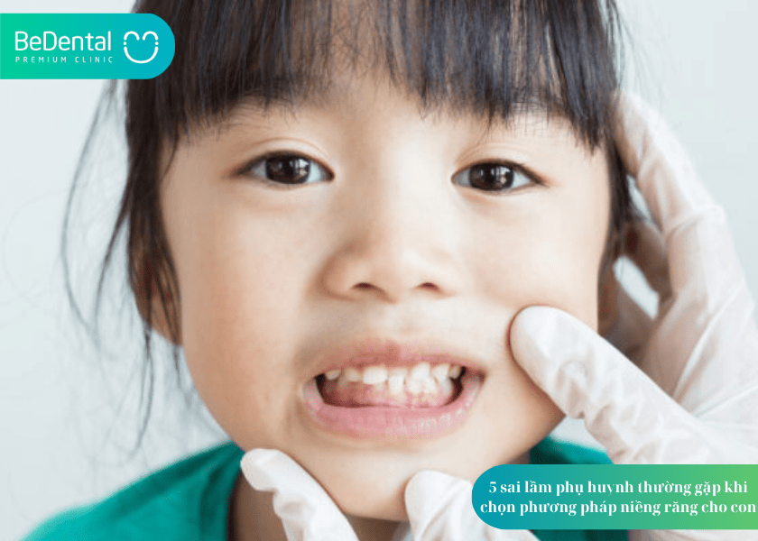 Niềng răng trẻ em và 5 sai lầm phụ huynh thường gặp khi chọn phương pháp niềng răng cho con 3 How much does teeth whitening cost 10 min