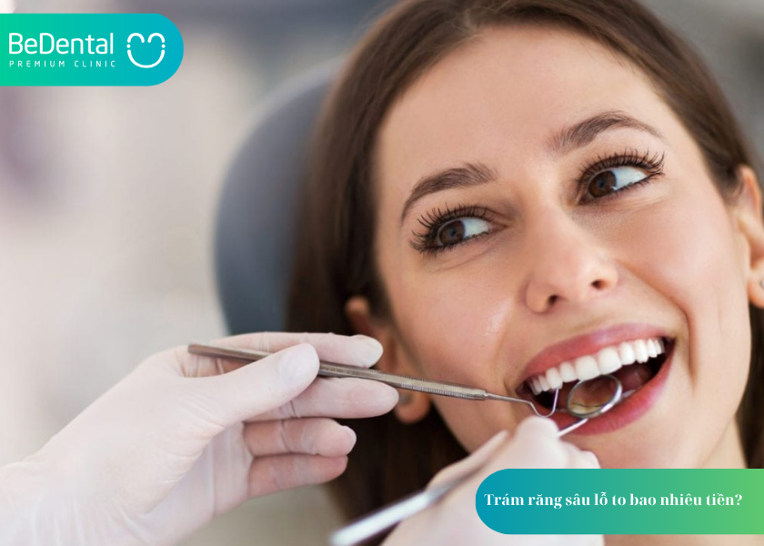 Trám Răng Sâu Lỗ To Bao Nhiêu Tiền? Giá Cả và 5 Thắc Mắc Phổ Biến 2 Trám răng sâu lỗ to bao nhiêu tiền? Trám răng sâu lỗ to bao nhiêu tiền?