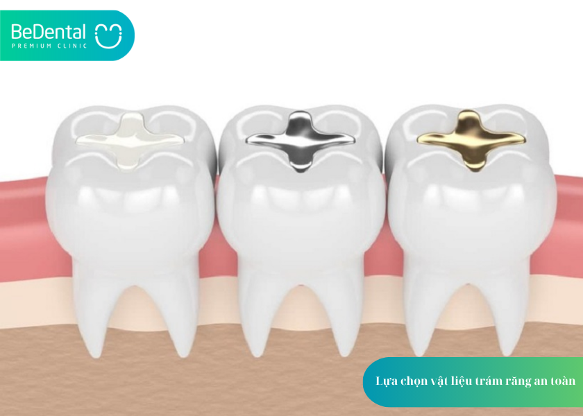 Bà Bầu Có Trám Răng Được Không? 5 Lưu Ý Quan Trọng 5 How much does teeth whitening cost 11