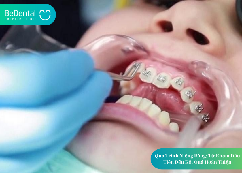 How much does teeth whitening cost 12 1