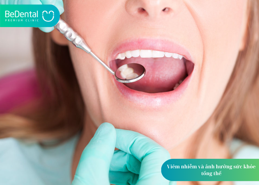 Răng Khôn Mọc Ngang: Nguy Hiểm Như Thế Nào Và Xử Lý Ra Sao? 4 How much does teeth whitening cost 12 2