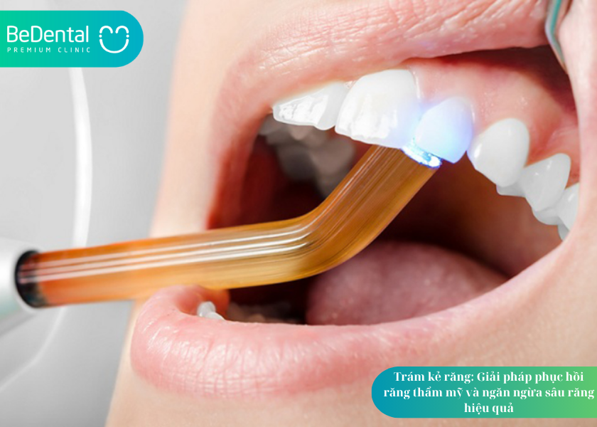 How much does teeth whitening cost 12 4