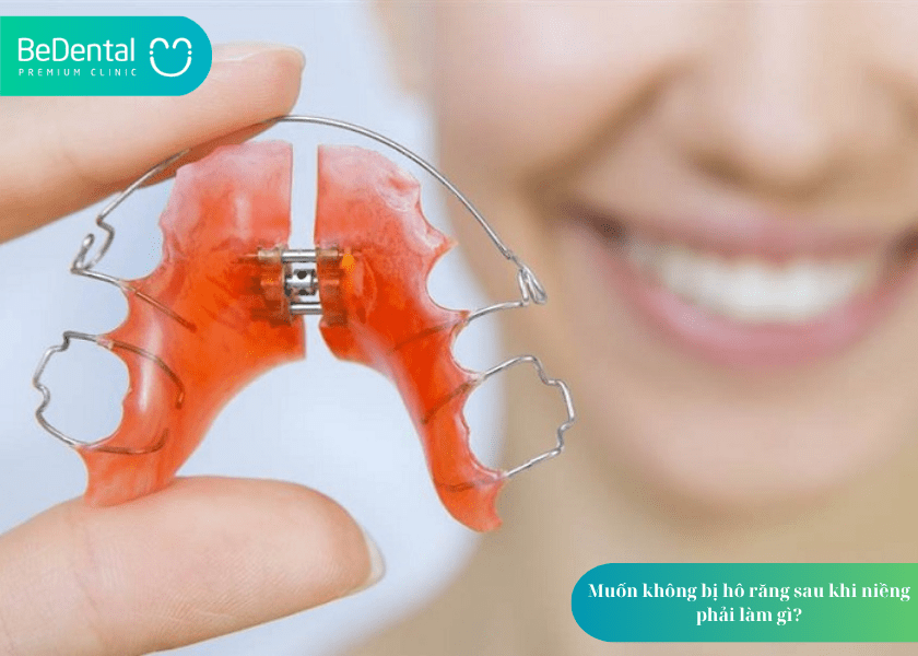 Niềng răng xong bị hô: Vì sao lại xảy ra và cách khắc phục? 5 How much does teeth whitening cost 12 min 1