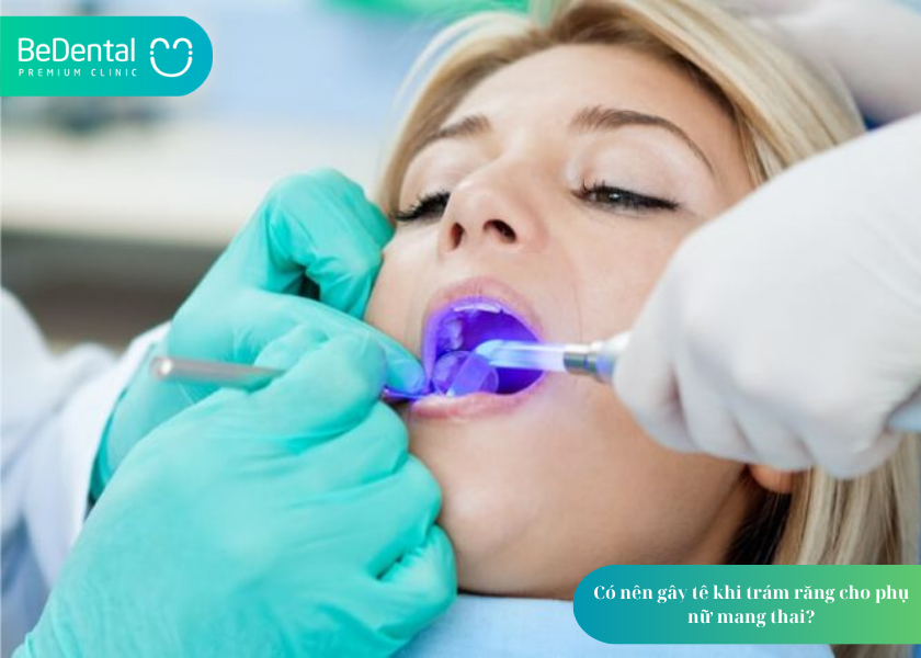 Bà Bầu Có Trám Răng Được Không? 5 Lưu Ý Quan Trọng 6 How much does teeth whitening cost 12